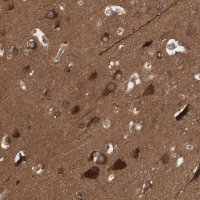 Anti-YWHAB antibody produced in rabbit 