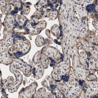 Anti-ZADH2 antibody produced in rabbit 
