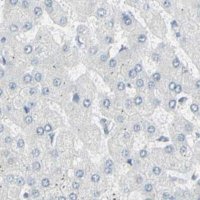 Anti-ZBTB7B antibody produced in rabbit 