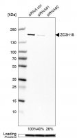 Anti-ZC3H18 antibody produced in rabbit 
