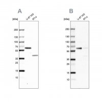 Anti-ZC3HC1 antibody produced in rabbit 