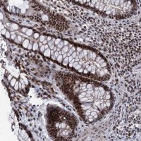 Anti-ZCCHC10 antibody produced in rabbit 