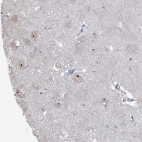 Anti-ZCCHC12 antibody produced in rabbit HPA031016-100UL