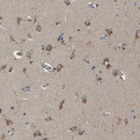 Anti-ZDHHC17 antibody produced in rabbit 