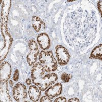 Anti-ZDHHC4 antibody produced in rabbit 