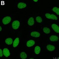 Anti-ZEB1 Antibody, clone 5C20 ZooMAb Rabbit Monoclonal 