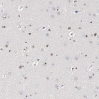 Anti-ZEB2 antibody produced in rabbit 