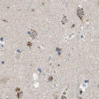 Anti-ZFPL1 antibody produced in rabbit 