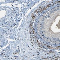 Anti-ZMAT1 antibody produced in rabbit 