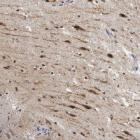 Anti-ZMYND8 antibody produced in rabbit 