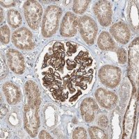 Anti-ZNF16 antibody produced in rabbit 