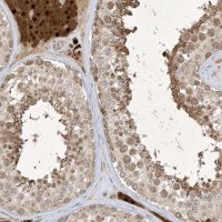 Anti-ZNF213 antibody produced in rabbit 