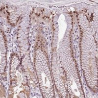 Anti-ZNF217 antibody produced in rabbit 