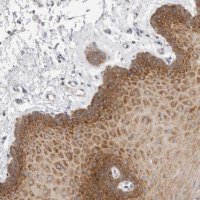 Anti-ZNF23 antibody produced in rabbit 