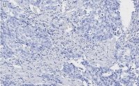 Anti-Zyxin Antibody, clone 2F17 ZooMAb Rabbit Monoclonal 