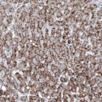 Monoclonal Anti-ABCD3 antibody produced in mouse 
