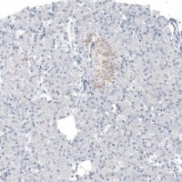 Monoclonal Anti-AMACR antibody produced in mouse AMAB91561-100UL