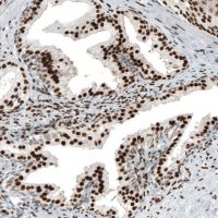 Monoclonal Anti-AR antibody produced in mouse AMAB91547-100UL
