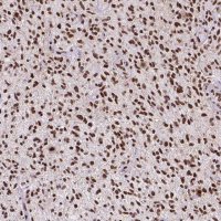 Monoclonal Anti-ATRX antibody produced in mouse 