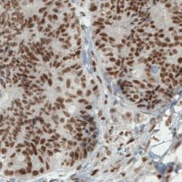 Monoclonal Anti-ERCC1 antibody produced in mouse 