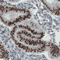 Monoclonal Anti-ESR1 antibody produced in mouse 