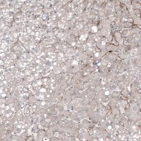 Monoclonal Anti-FOLH1 antibody produced in mouse AMAB91551-100UL