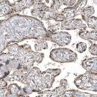 Monoclonal Anti-HDAC5 antibody produced in mouse AMAB91501-100UL