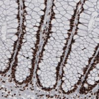 Monoclonal Anti-HNRNPC antibody produced in mouse 