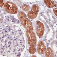 Monoclonal Anti-IDH1 antibody produced in mouse 
