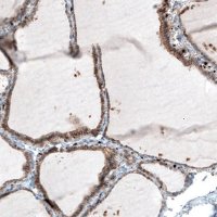Monoclonal Anti-ITGB3 antibody produced in mouse 