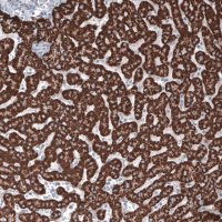 Monoclonal Anti-OTC antibody produced in mouse 
