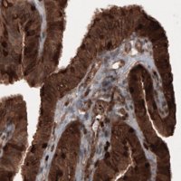 Monoclonal Anti-PFN1 antibody produced in mouse 