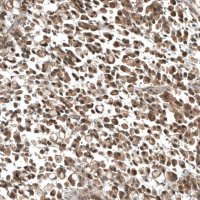 Monoclonal Anti-PIK3CA antibody produced in mouse AMAB91514-100UL