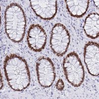Monoclonal Anti-SATB2 antibody produced in mouse 
