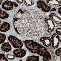 Monoclonal Anti-SDHB antibody produced in mouse 