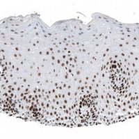 Monoclonal Anti-SETD2 antibody produced in mouse AMAB91603-100UL