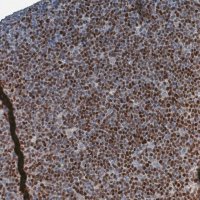 Monoclonal Anti-SOX11 antibody produced in mouse 