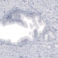 Monoclonal Anti-SPAG5 antibody produced in mouse AMAB91605-100UL