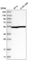 Anti-43351 antibody produced in rabbit HPA036534-100UL