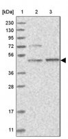 Anti-AARSD1 antibody produced in rabbit HPA023714-100UL
