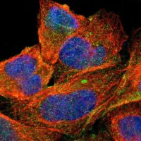 Anti-ABCC1 antibody produced in rabbit 