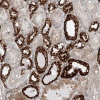 Anti-ABCC11 antibody produced in rabbit 