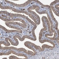 Anti-ABCF3 antibody produced in rabbit 