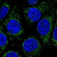 Anti-ABHD11 antibody produced in rabbit 