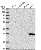 Anti-ABHD14A antibody produced in rabbit HPA038153-100UL