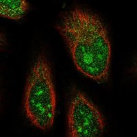 Anti-ABHD14B antibody produced in rabbit 