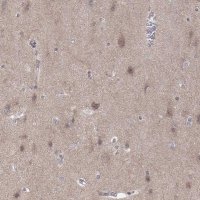 Anti-ABL2 antibody produced in rabbit 