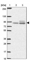 Anti-ABR antibody produced in rabbit HPA054824-100UL