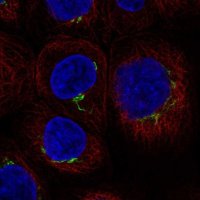 Anti-ACAP1 antibody produced in rabbit 