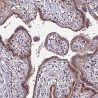 Anti-ACKR3 antibody produced in rabbit 